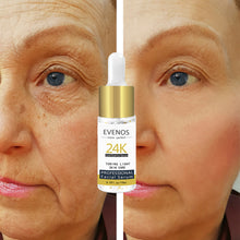 Load image into Gallery viewer, EVENOS 24K Golden Hexapeptide Essence Anti-Aging Anti-Wrinkle Whitening Moisturizing Treatment of Sores