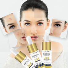 Load image into Gallery viewer, EVENOS 24K Golden Hexapeptide Essence Anti-Aging Anti-Wrinkle Whitening Moisturizing Treatment of Sores