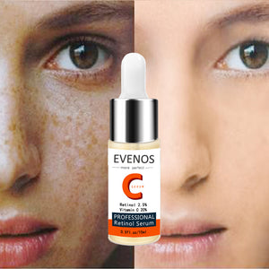 EVENOS Vitamin C Whitening Serum Hyaluronic Acid Face Essence Remover Acne Treatment Fade Dark Spots Anti-wrinkle Anti-Aging